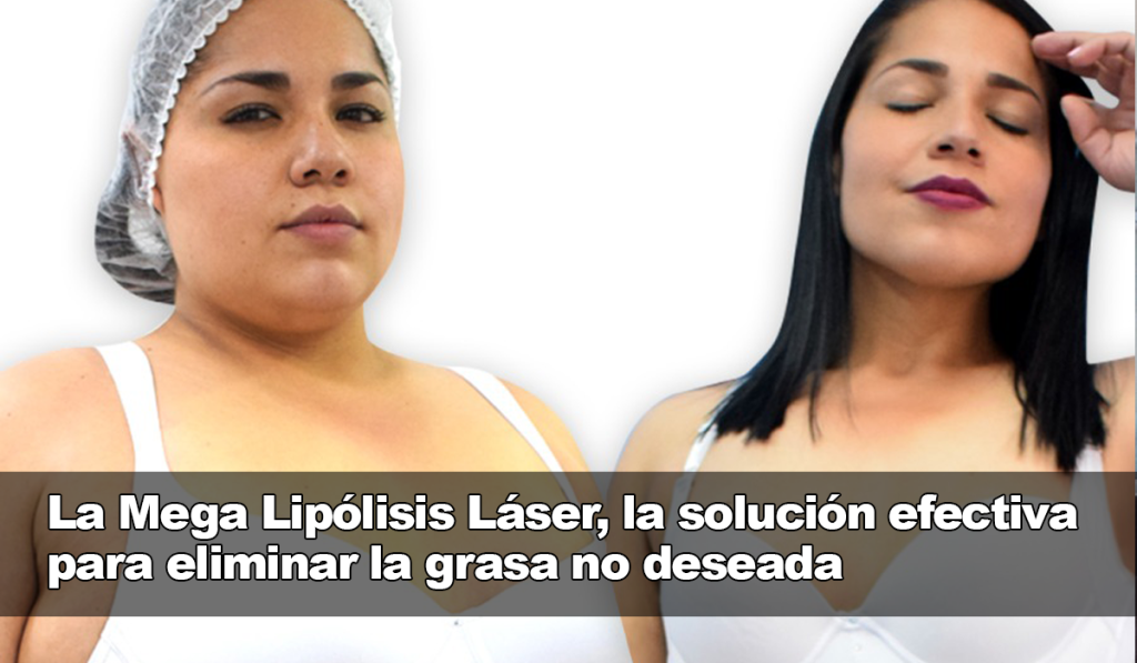 La Mega Lipólisis Láser, la solución efectiva para eliminar la grasa no deseada